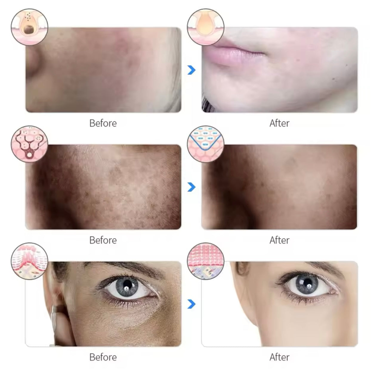 LED light face mask